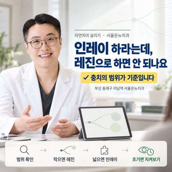 인레이 하라는데 레진으로 하면 안 되나요? 어금니 충치에서 나누는 기준 - 서울온뉴치과 원장 칼럼
